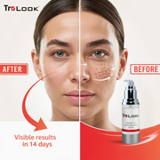 TruLook Vitamin C + hyaluronic Acid Serum, Anti Aging, Anti Wrinkle, Improves Dark Spots, Tone, & Fine Lines Made is USA