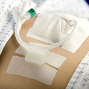 Cath Secure® Extended Tab Tube Holder - Image 2